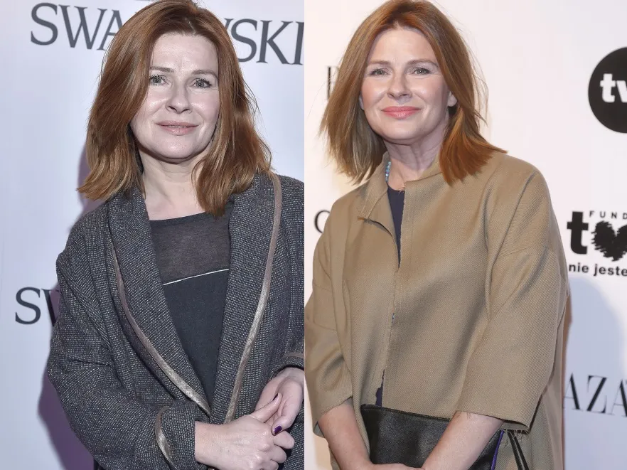 Kierunek: gładkość i zmiana objętości. Zmiany na twarzy Anny Maruszeczko