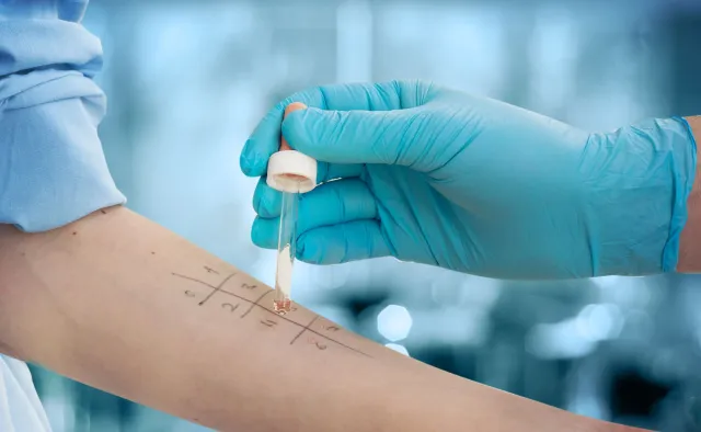 Uczula nas coraz więcej substancji chemicznych. Rośnie liczba alergików