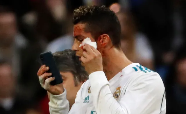 Liga hiszpańska: Popis Realu w meczu z Deportivo. Zakrwawiony Ronaldo opuścił boisko