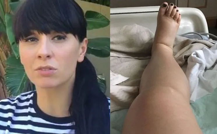 Tatiana Okupnik pokazała, co stało się z jej ciałem po porodzie: Każda Mama ma inną historię