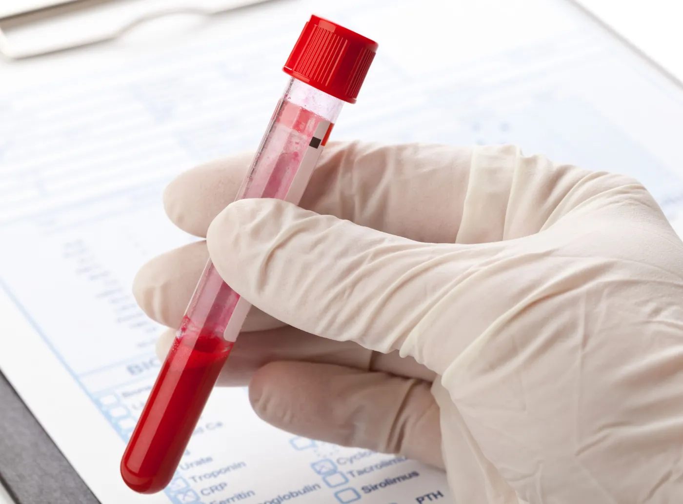 Osocze łagodzi objawy COVID-19, skraca czas choroby, obniża śmiertelność