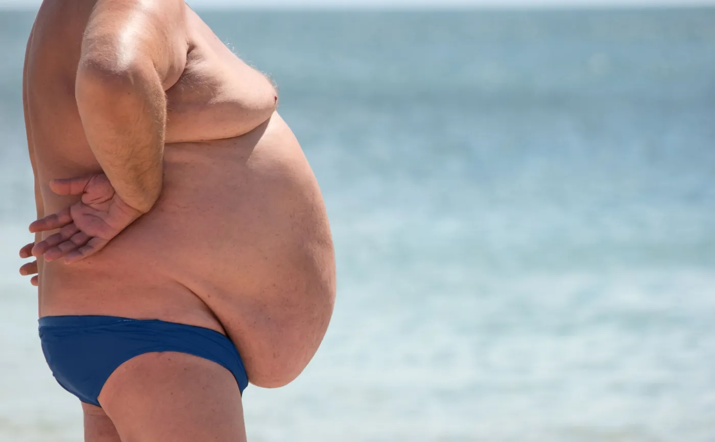 OTYŁOŚĆ to groźna choroba, która przyjęła skalę prawdziwej epidemii