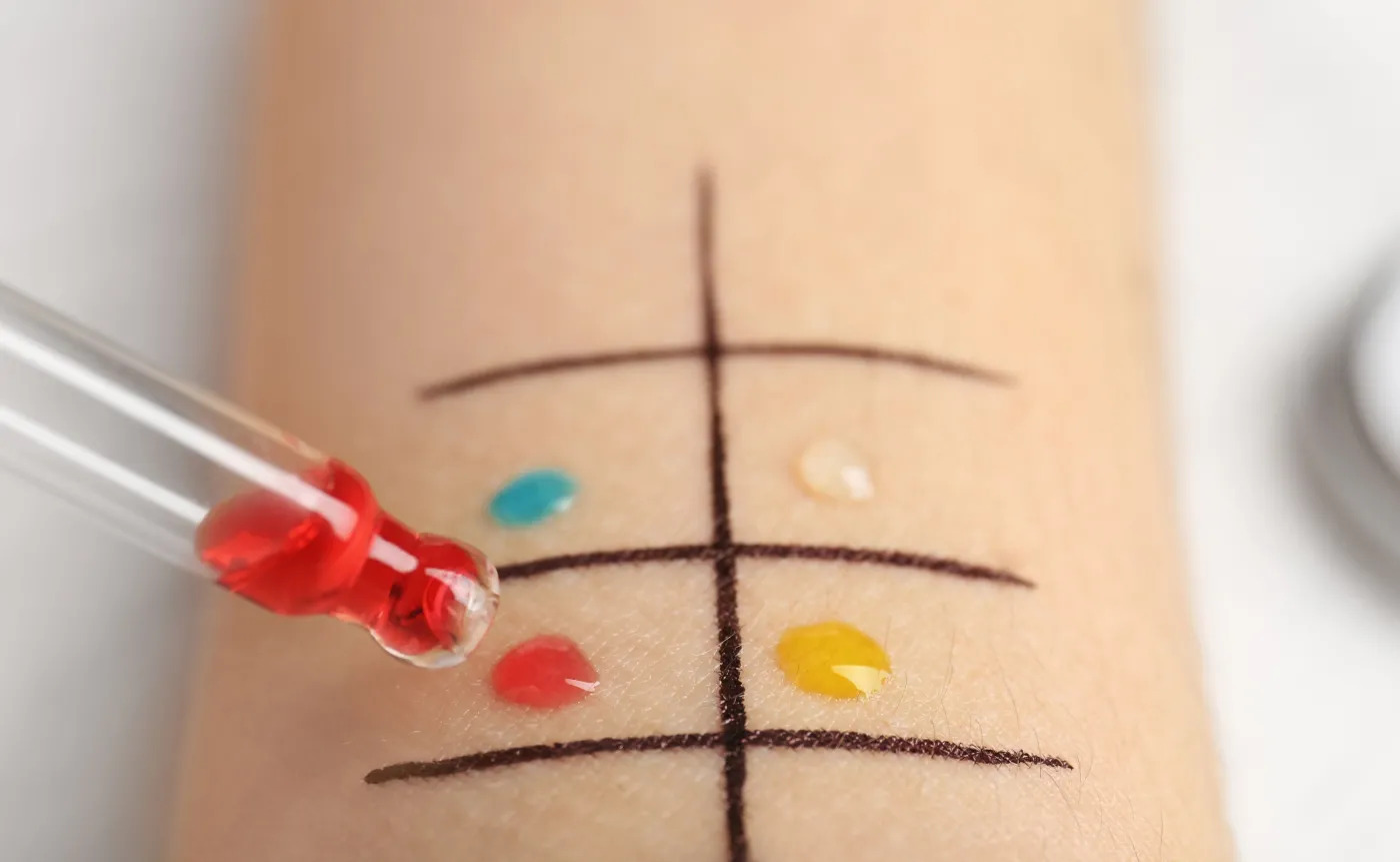 Nabyta odporność na niektóre alergeny pokarmowe może chronić przed COVID-19