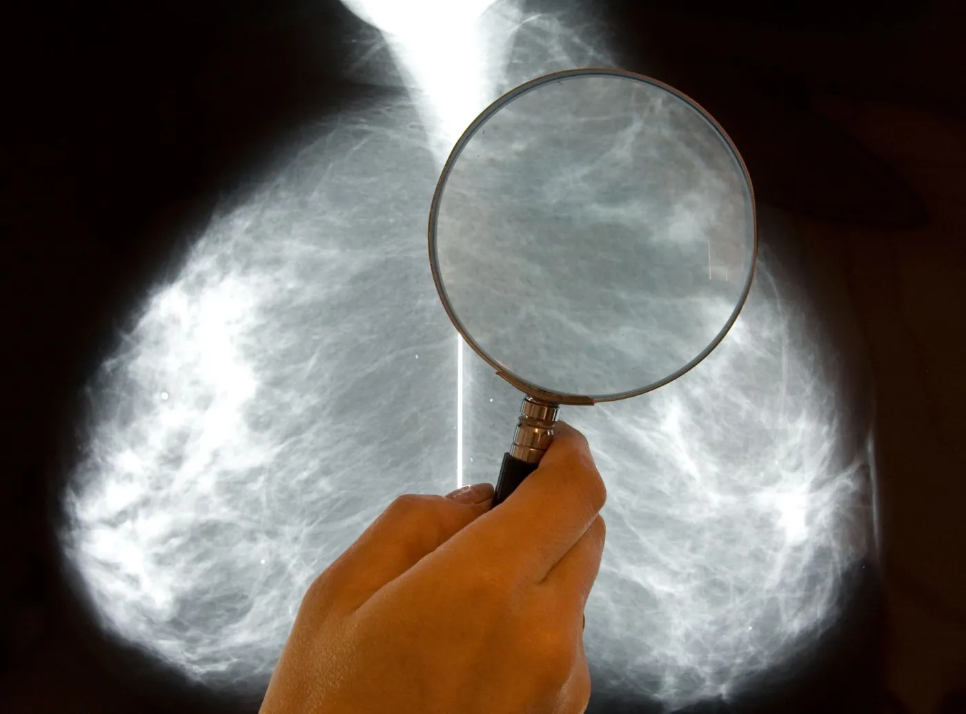 Mammobusy ruszyły w trasę. Można skorzystać z bezpłatnej mammografii