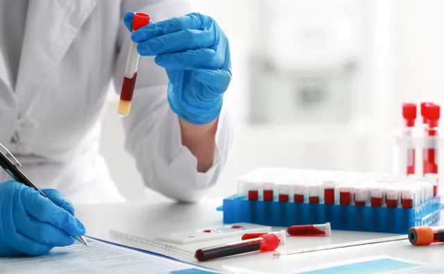 Badanie krwi może wskazać, którzy pacjenci są narażeni na zgon z powodu COVID-19