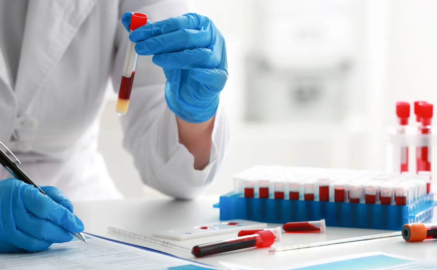 Osocze ozdrowieńców na początek zostanie podane stu chorym