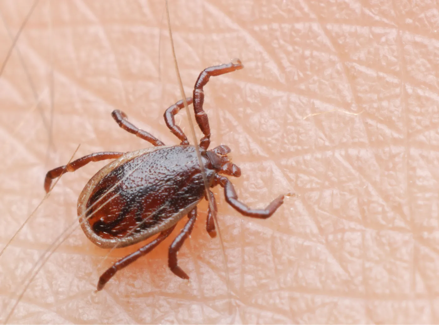 Kleszcze zaczęły polowanie. Jak nie być dla nich łatwym celem?