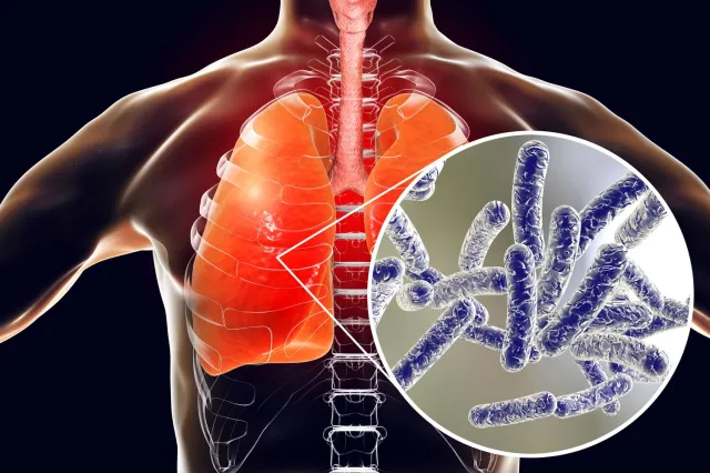 Legionella na Podkarpaciu. Minister zdrowia zwołała sztab kryzysowy