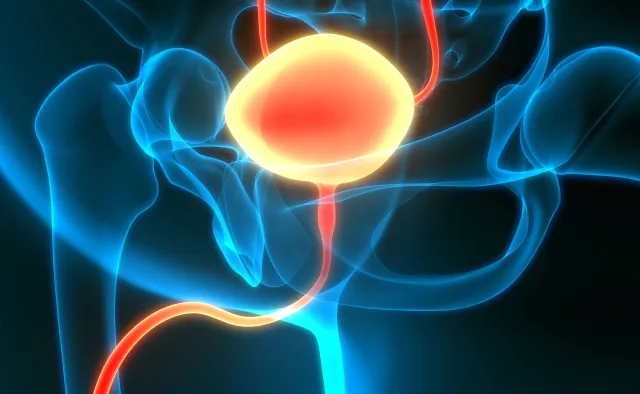 Rak pęcherza moczowego częściej dotyka mężczyzn. Ale kobiety też powinny badać się urologa!