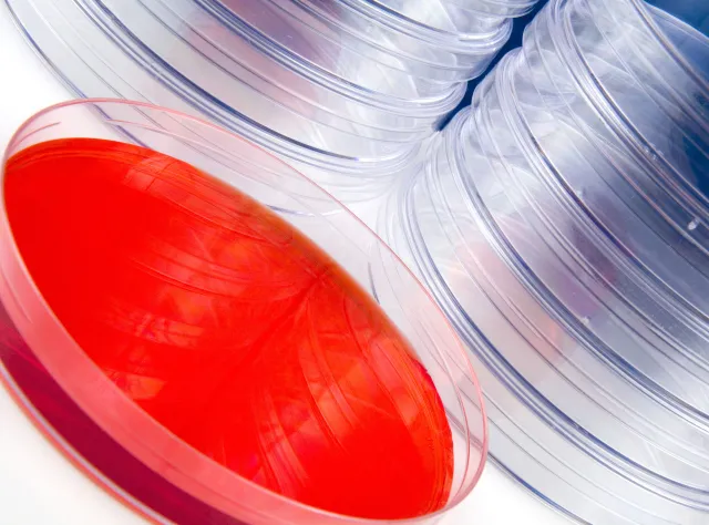 Dla kogo bezpłatna mammografia i cytologia? Zmiany w programach profilaktycznych