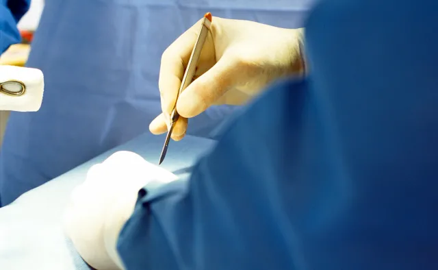 "Potrzebujemy narządów do przeszczepów od żywych dawców"