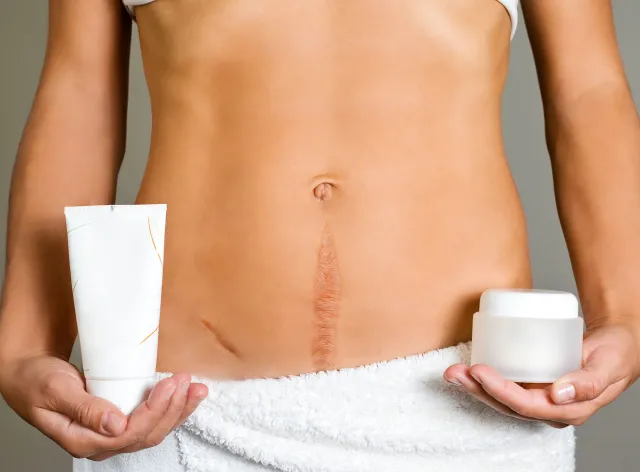 Skąd się biorą blizny i jak je leczyć?