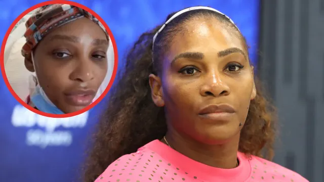 Serena Williams po operacji wycięcia guza. "Miał wielkość grejpfruta"