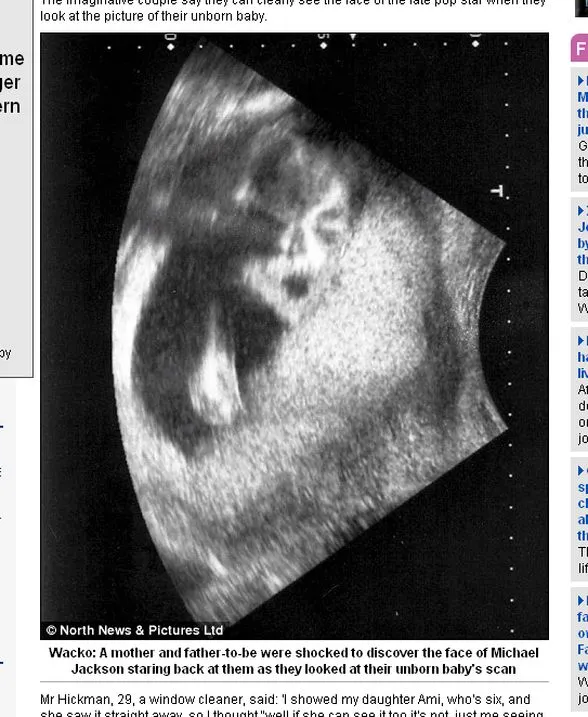 Brytyjka urodzi... Michaela Jacksona