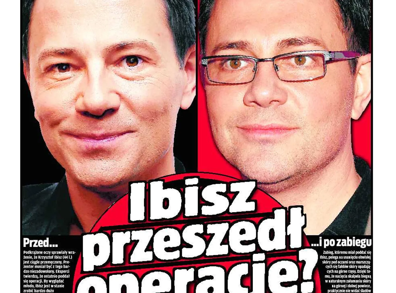 Czy Ibisz zrobił operację twarzy?