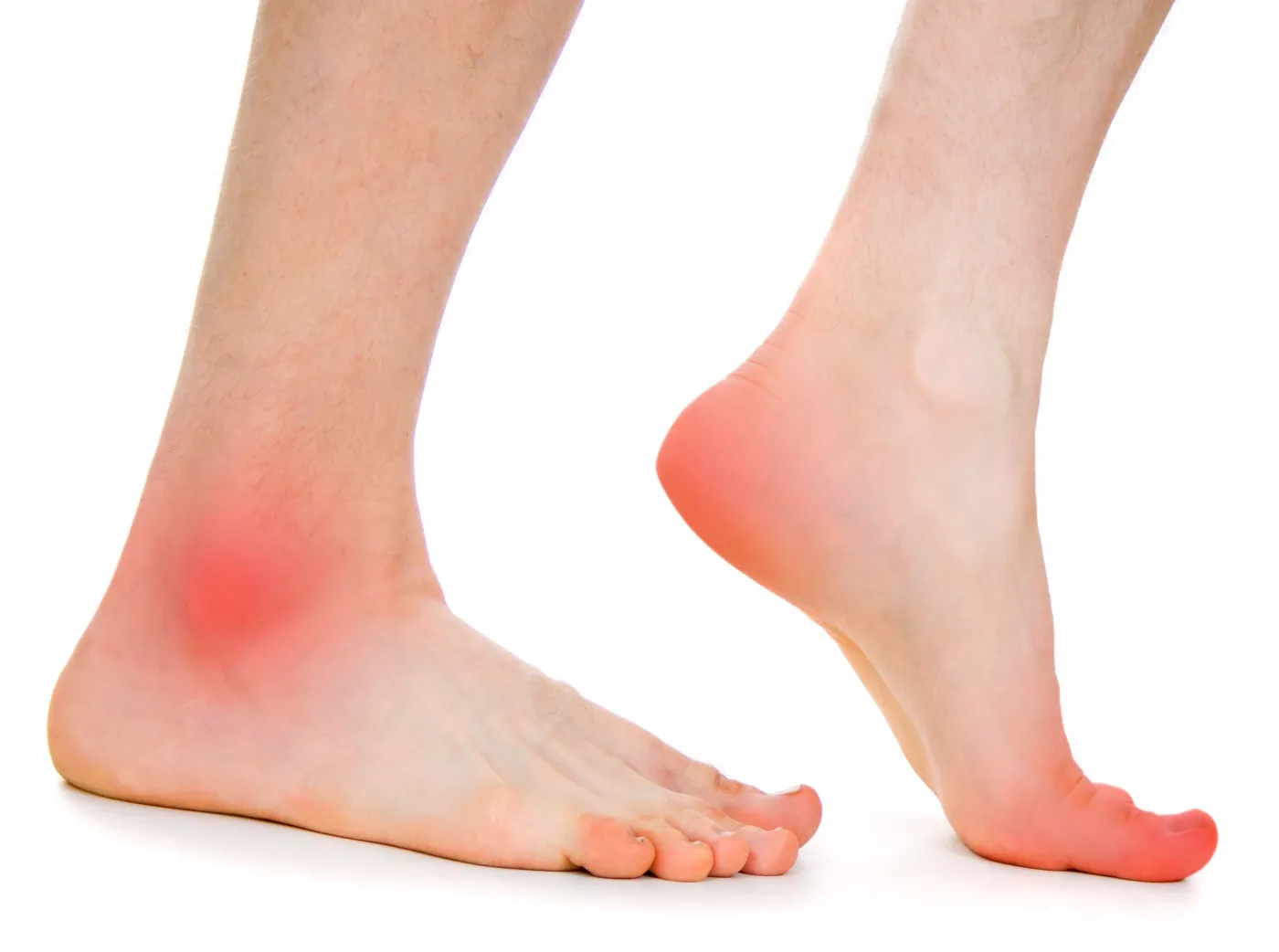 Jak opatrywać pęcherze i otarcia? Pierwsza pomoc