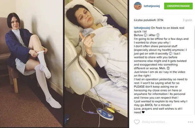 7908255-jessie-j-w-szpitalu.png