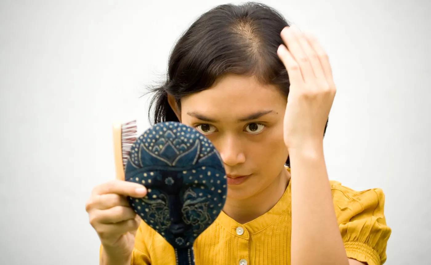 Kobieta traci włosy