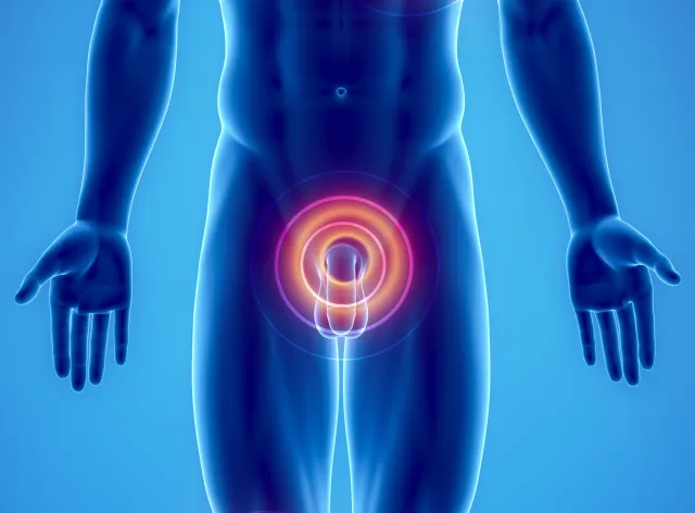 Bóle pleców, podbrzusza, kolka... to może być rak prostaty lub jądra. Jak to sprawdzić?