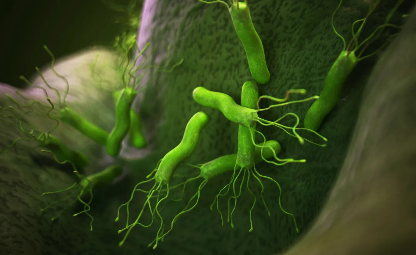 Główną przyczyną raka żołądka jest zakażenie tą (prostą do wyleczenia) bakterią