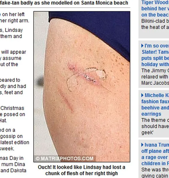 Lindsay Lohan zamiast ciała pokazuje blizny