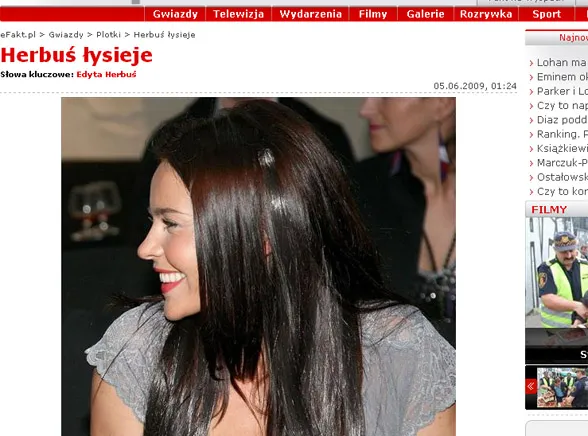 Edyta Herbuś łysieje?