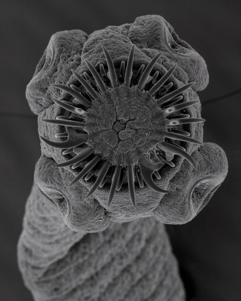 fr_taenia_solium_260458a_872810.jpg