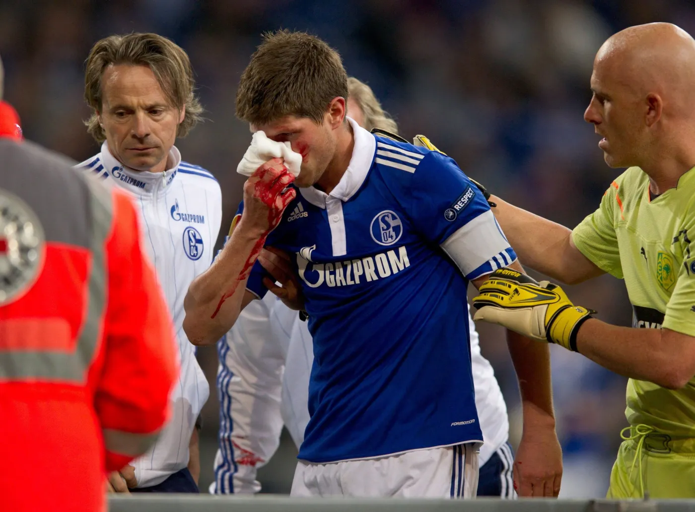 Napastnik Schalke ze złamanym nosem trafił do szpitala