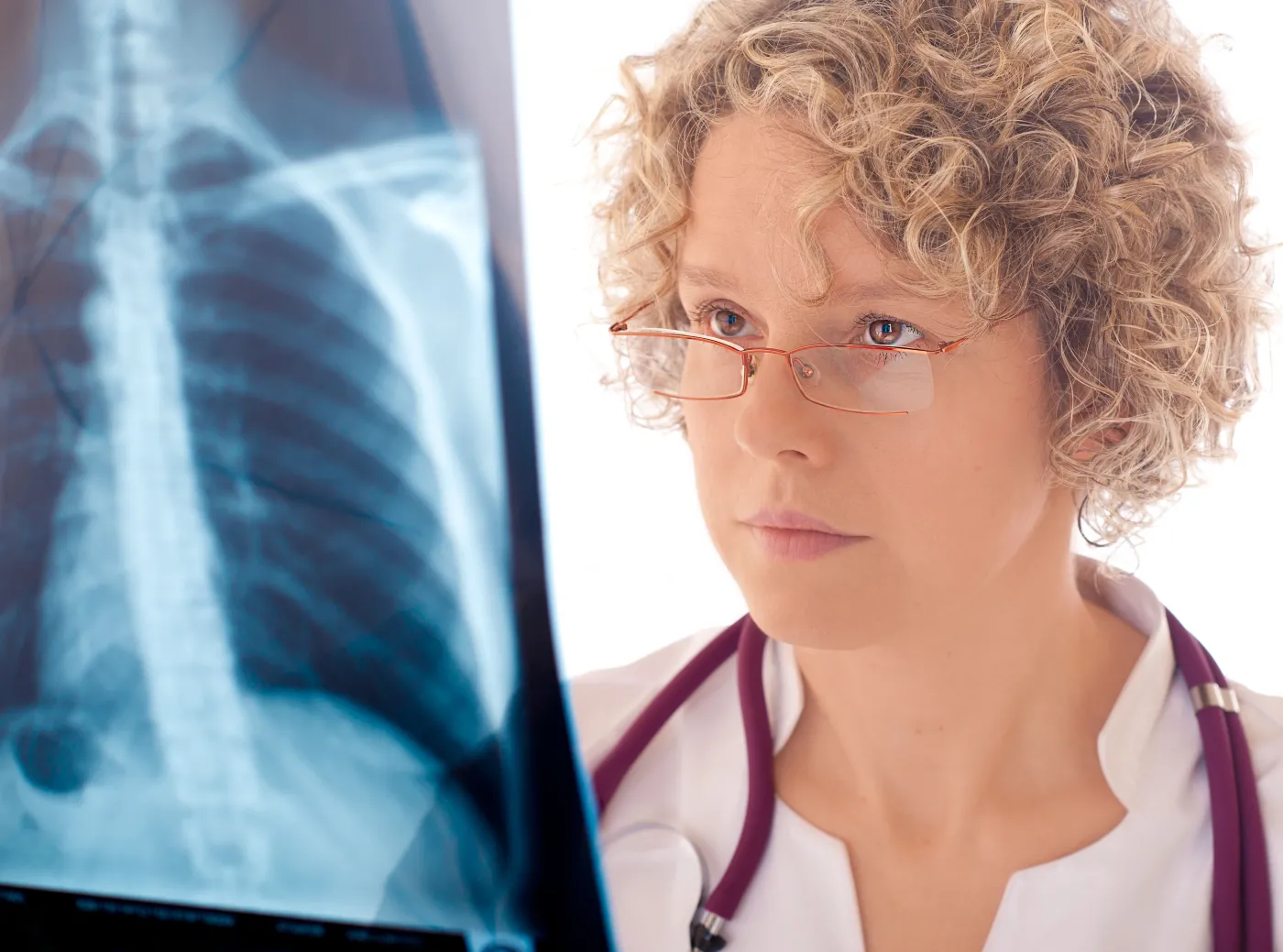 rtg płuc lekarz płuca