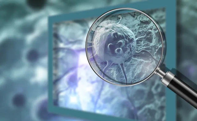 12 prostych kroków, które zmniejszają o połowę ryzyko raka