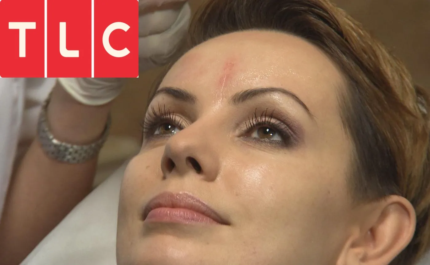 Gardias, Bohosiewicz i Rylik upiększają się przed kamerami. "Klinika urody gwiazd" na antenie TLC