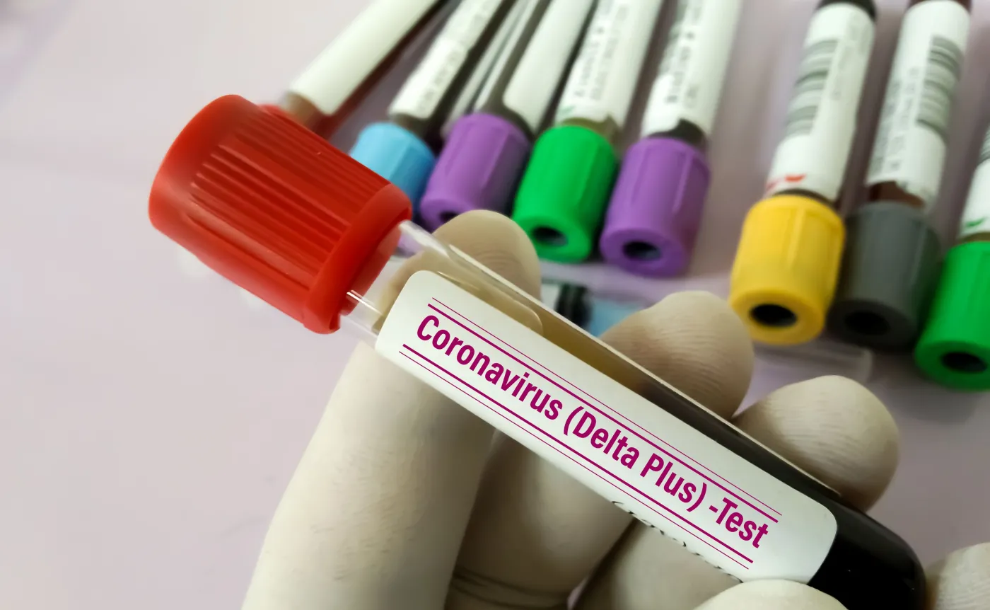 Rośnie liczba zakażeń w Czechach. Najczęściej chorują młodzi i niezaszczepieni