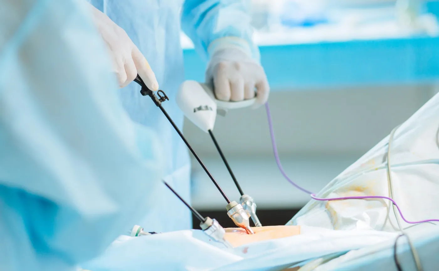 Operacja laparoskopowa