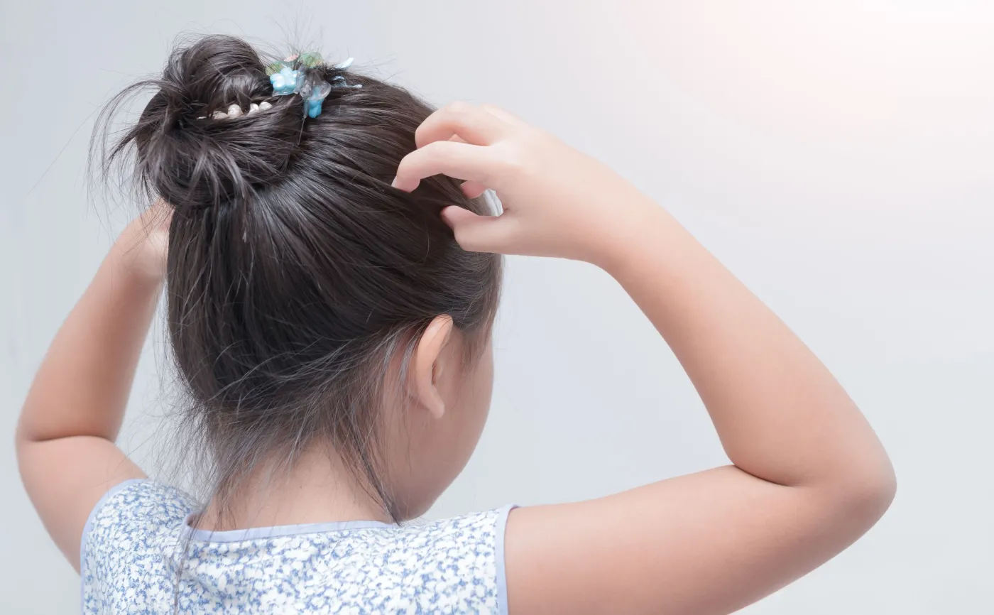 Wszawica nie jest problemem z odległej przeszłości. Warto przeglądać włosy