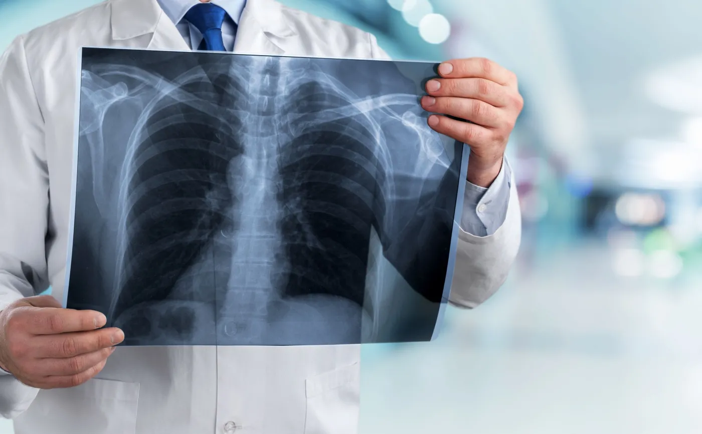 Lekarz ogląda RTG płuc