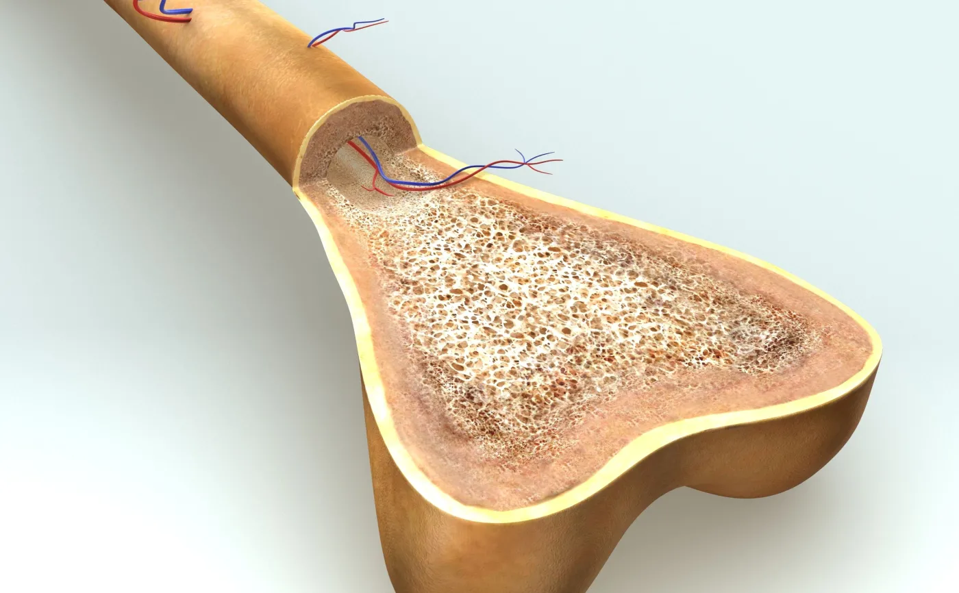Czy hydrożel stanie się implantem kostnym przyszłości?