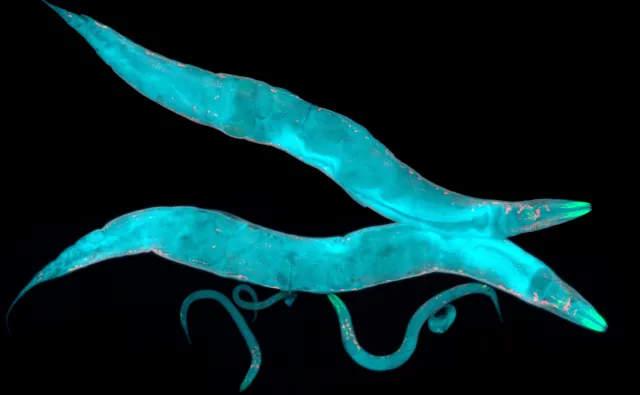 Parkinson zaczyna się w jelitach i rozprzestrzenia do mózgu? Ten robak pomaga to wyjaśnić