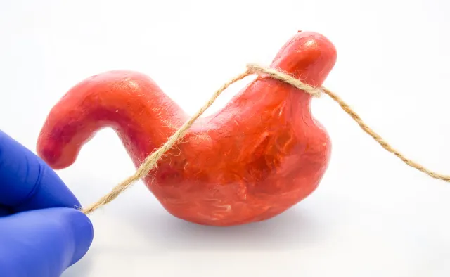 Operacja bariatryczna ratuje życie, a pacjent musi na nią czekać przynajmniej kilka miesięcy