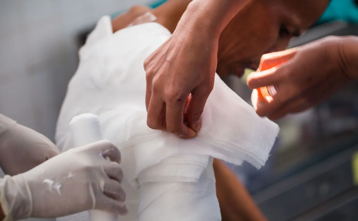 Opatrywanie rany, oparzenie