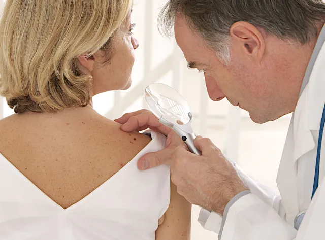 Jeden na trzech pacjentów z rakiem skóry umiera. Jak to zmienić?