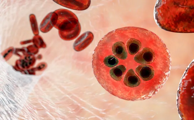 "To czarny scenariusz": Znaleziono szczególnie groźne zarodźce malarii