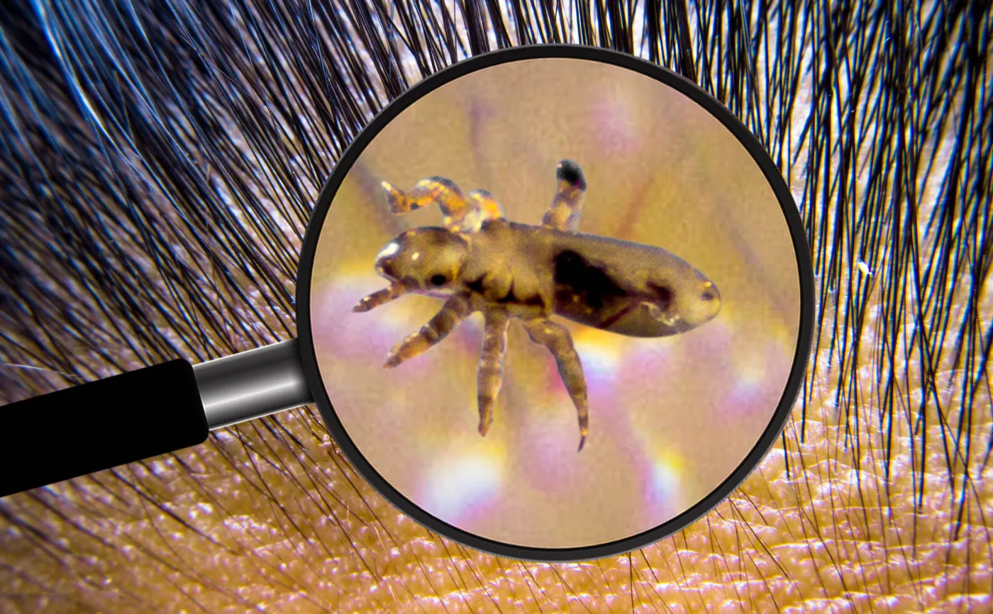 Nie lubią brudu, chętnie wybierają rzęsy. Prawdy i mity na temat wszy