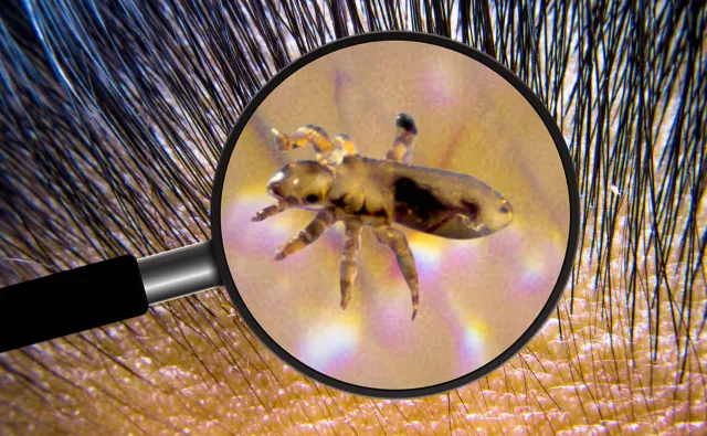 Nie lubią brudu, chętnie wybierają rzęsy. Prawdy i mity na temat wszy