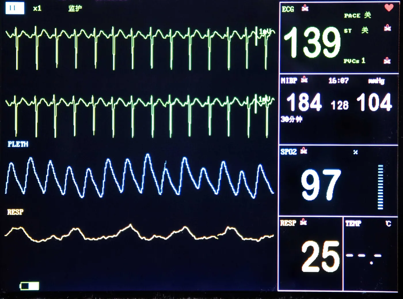 Krajowa Sieć Kardiologiczna przyjęta przez Sejm – co zmieni nowa ustawa?