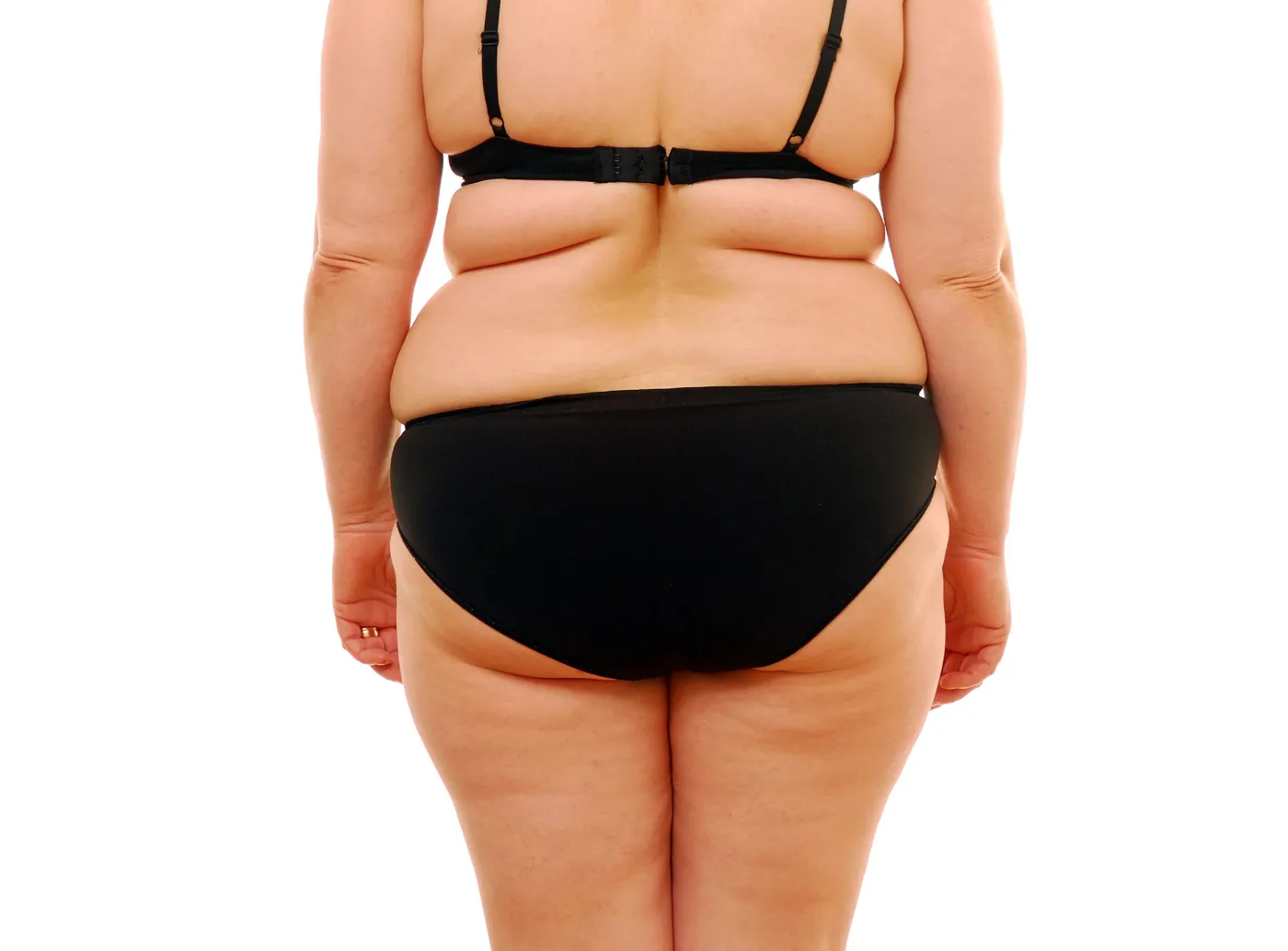 otyłość nadwaga dieta