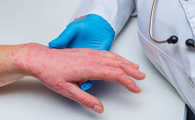 Eksperci: błędów medycznych nie da się uniknąć, ale nie można karać za nie lekarzy