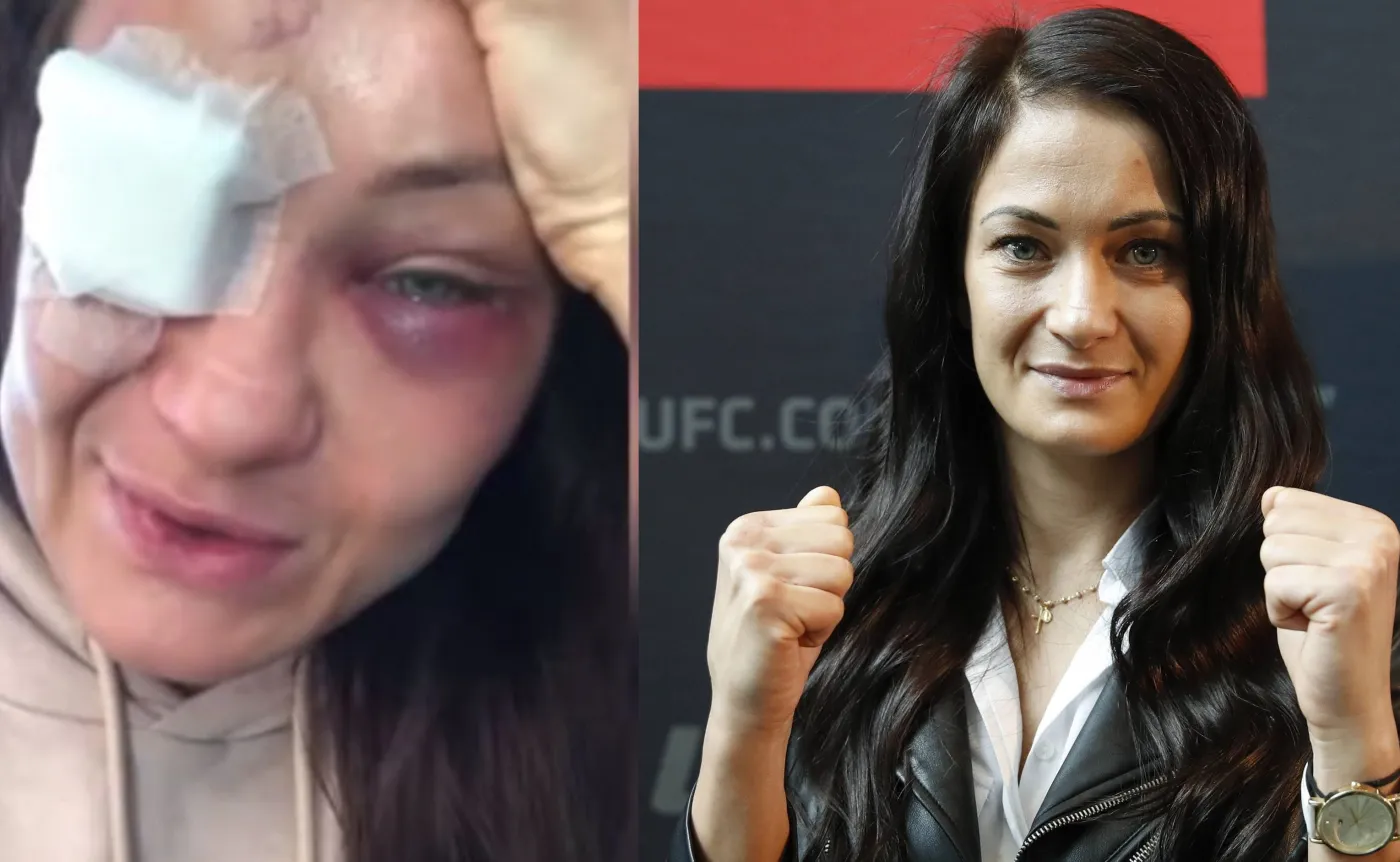 Kowalkiewicz czeka operacja. Jej oko mogło eksplodować [FOTO]