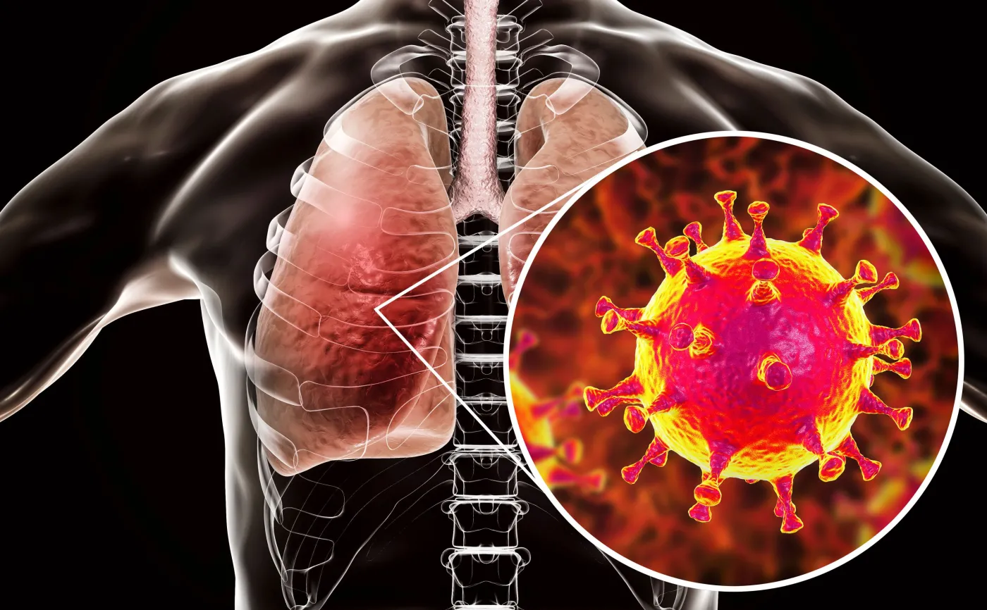 MZ i NFZ przekazały zalecenia ws. koronawirusa z Wuhan