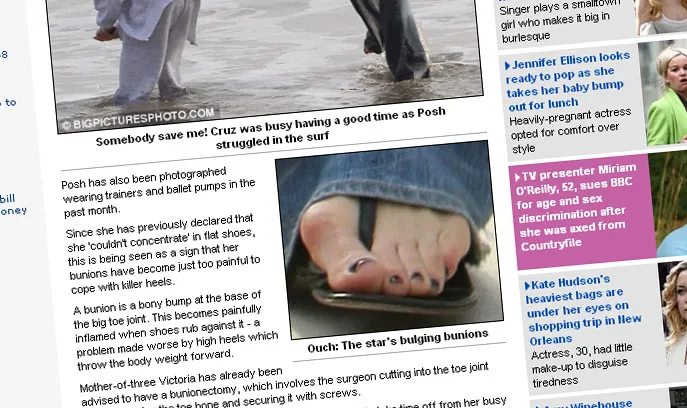 Zobacz stopę Beckham. Uwaga! Jest straszna