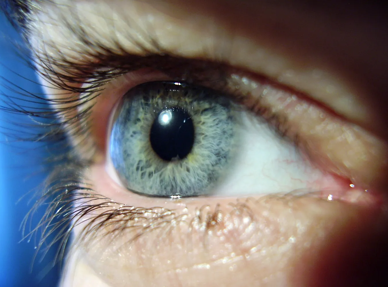 Co zrobić, gdy wiosną łzawią oczy